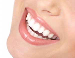 comment avoir les dents blanches avec un appareil dentaire